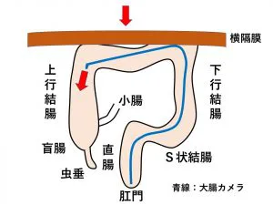 s 状 ストア 結腸 カメラ