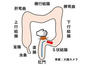 s 状 結腸 カメラ